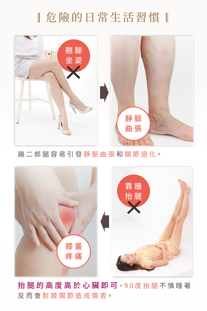 蹺二郎腿容易引發靜脈曲張和關節退化。 