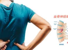 消滅坐骨神經痛不必挨刀! 勤練「3式舒緩妙招」讓筋骨軟回來